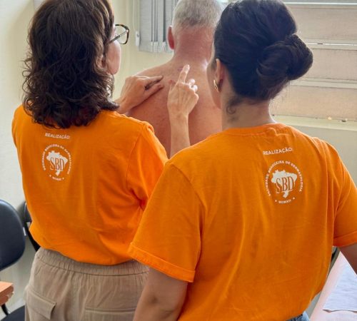 Mutirão de prevenção de Câncer de Pele realiza mais de 250 atendimentos gratuitos no HMUT